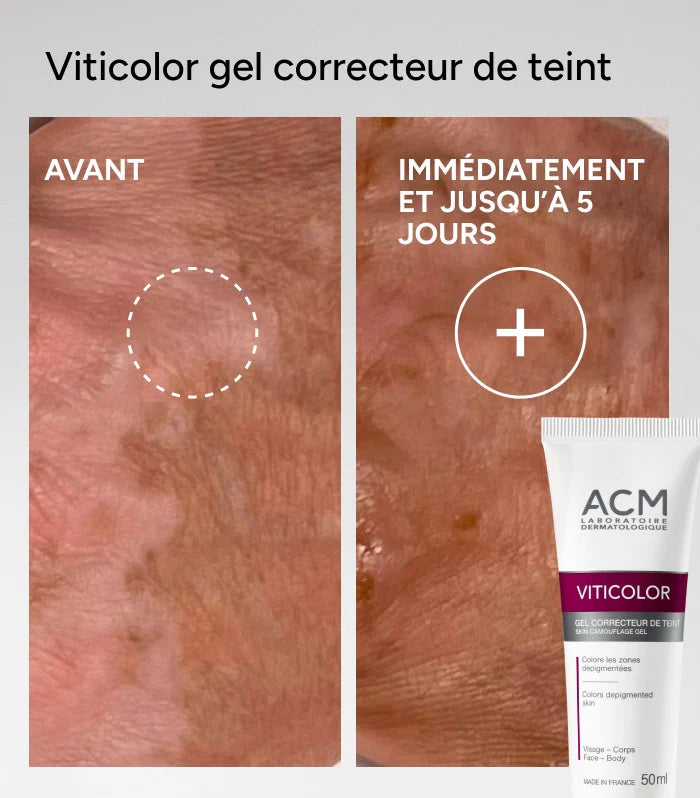 ACM VITICOLOR GEL CORRECTEUR DE TEINT 50ML