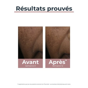 EUCERIN ANTI PIGMENT SPOT CORRECTEUR DE TACHES 5ML