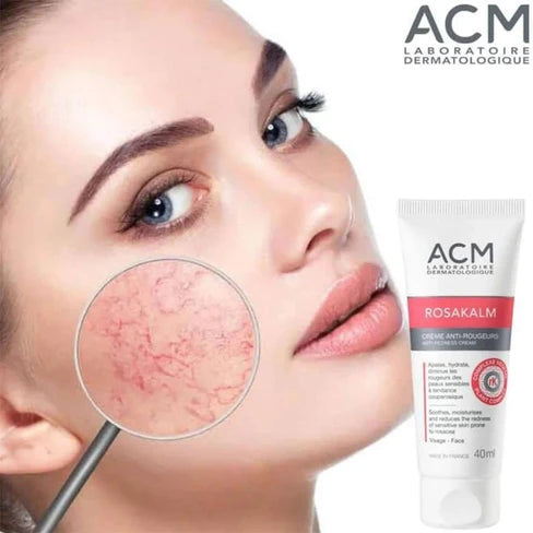 ACM ROSAKALM CREME APAISANTE ANTI-ROUGEURS 40ML